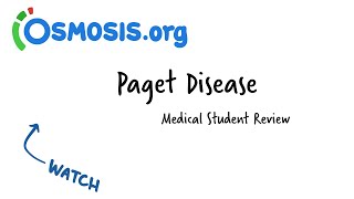 Paget Disease Osmosis Study Video