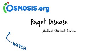 Paget Disease: Osmosis Study Video screenshot 3