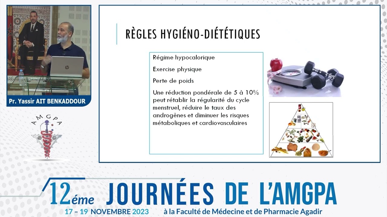 Ovaires polykystiques/métrorragies/Pr  Yassir AIT BENKADDOUR