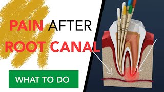 Pain After Root Canal | WHAT TO DO