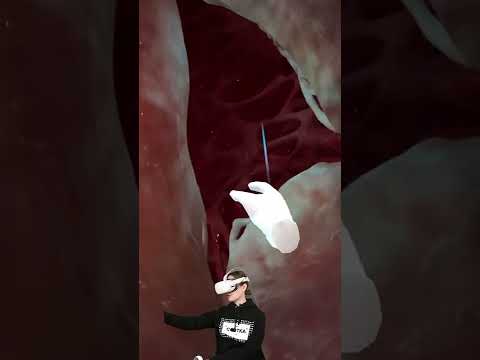 Строение сердца с Альбиной Амировой
