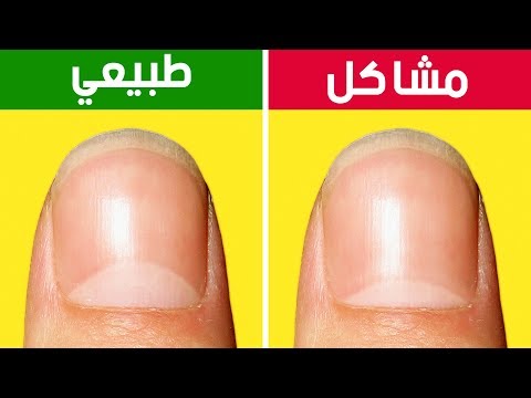 13 مشكلة صحية تحذرك حولها أظافرك