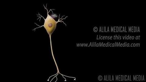 Beta amyloid and Tau proteins (transglutaminase substrates) ALILA