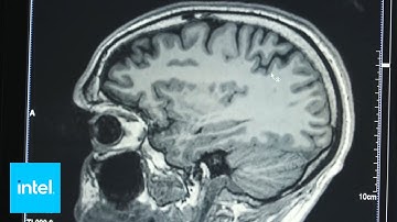 Decoding Data from Brain Scans Using Intel AI Technology | Intel Business