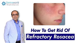 How To Get Rid Of Refractory Rosacea | Rosacea Treatment by Dr. Rohit Batra