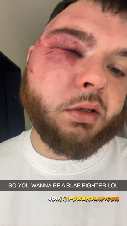 So you wanna be a Power Slap Fighter? #powerslap #crazy #fight #shorts
