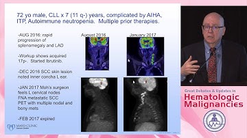 Management of adverse events with newer agents for CLL