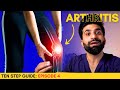 Rheumatoid arthritis complete guide  doctor explains 