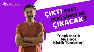 Çıktı Evet Peki Şimdi Ne Çıkacak? I Pankreasın Kistik Tümörleri