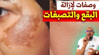 إزالة البقع السوداء وتصبغات البشرة وصفات الدكتور عماد ميزاب Docteur Imad Mizab