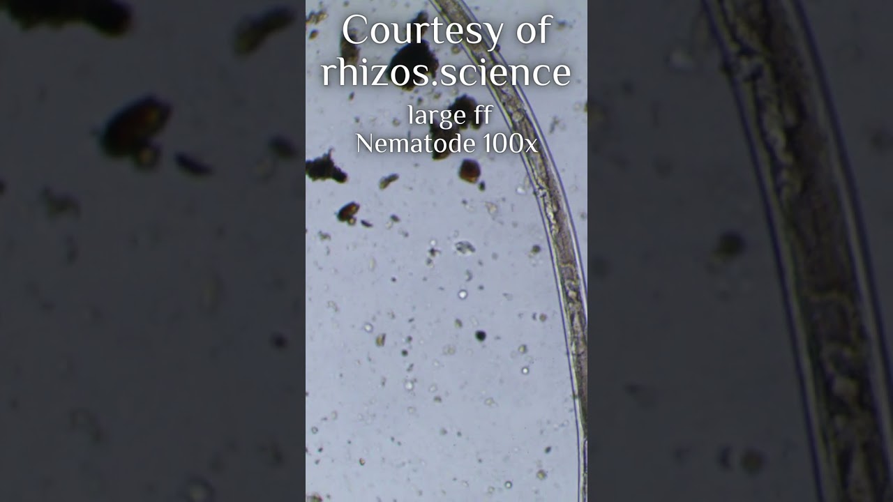 Large ff Nematode 100x