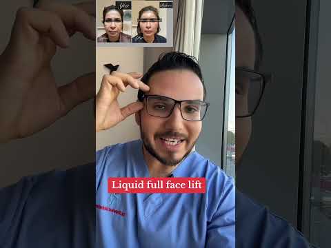 شد الوجه الغير جراحي Shorts 