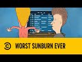 Worst Sunburn Ever | Beavis And Butt-Head | Comedy Central Africa