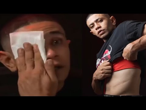 من هو البطل المصري محمد مسعود المعروف ب بوجي متعافي قصة المصري بوجي وكم عمره