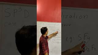 SP3D HYBRIDIZATION, ONE QUESTION SURE in NEET & JEE EXAM