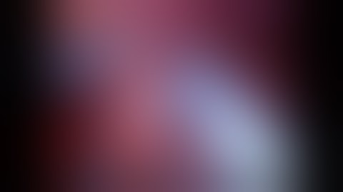 Robotic partial nephrectomy in complex Hilar Tumour