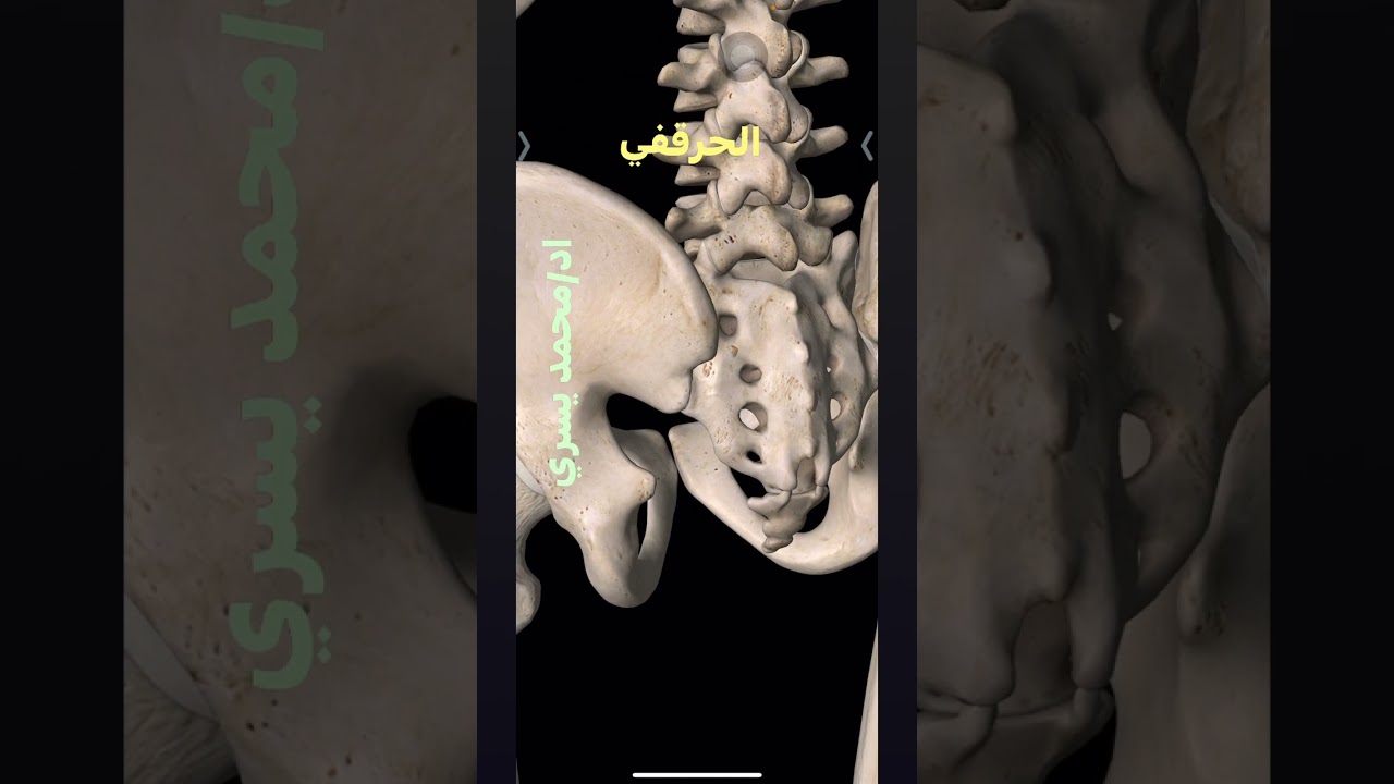 شرح و علاج مصدر الم  مفصل الحوض = سكروالياك= العجزي الحرقفي يشرحها اد/محمد يسري