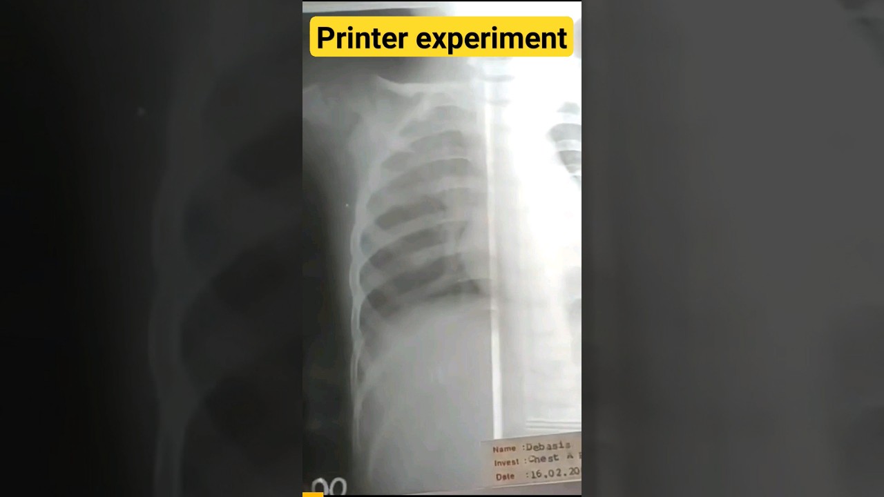 Xray printer experiment shocking results youtube