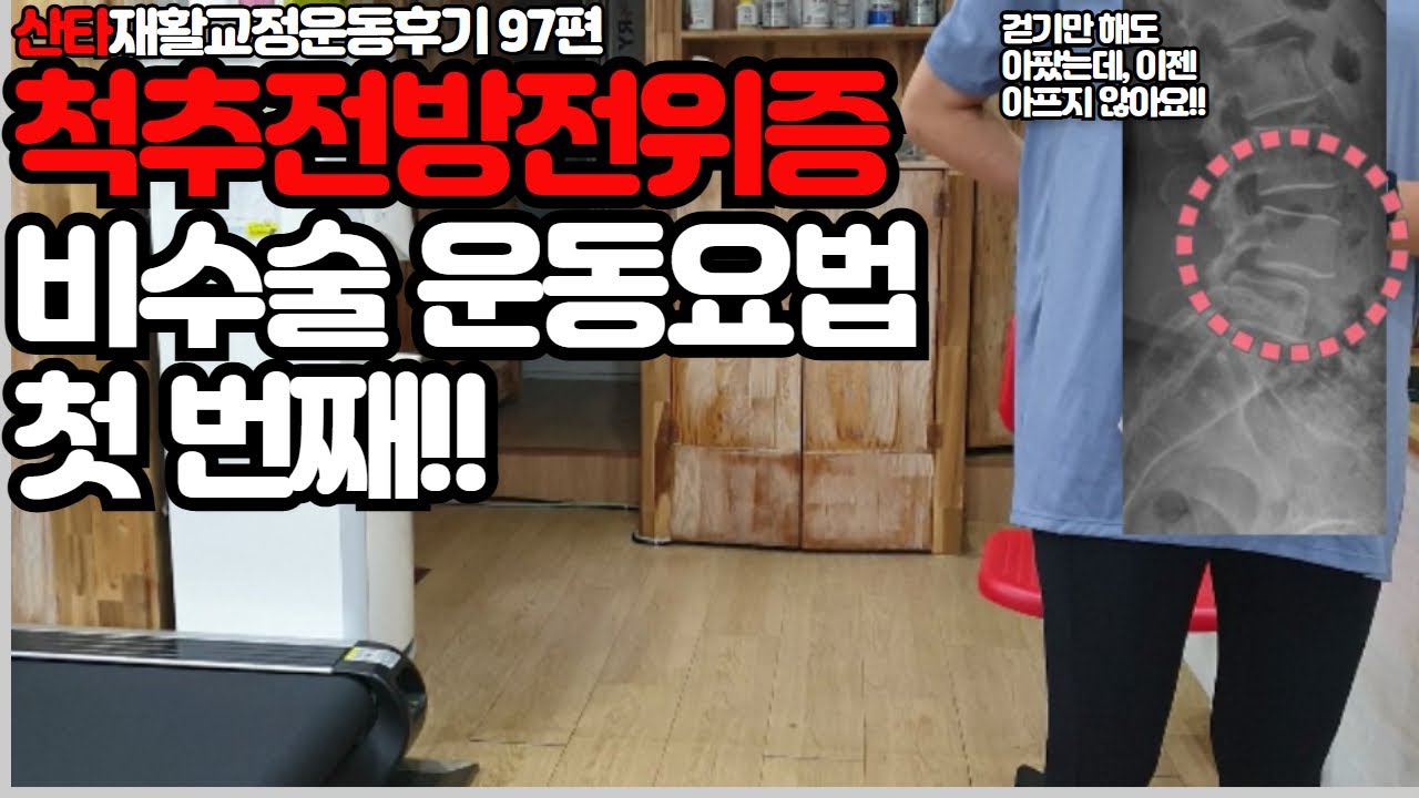 척추전방전위증 수술 없이 좋아지는 자세&운동 첫번째!(with. 산타재활운동후기97편)