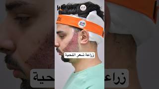 ‏مراحل زراعة شعر اللحية زراعةالشعر زراعة￼