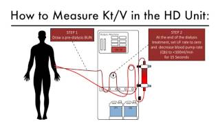 Hemodialysis Kinetics 101 07 How To Measure Kt/V