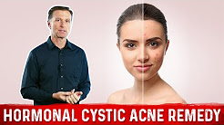 Best Remedy for Hormonal Cystic Acne