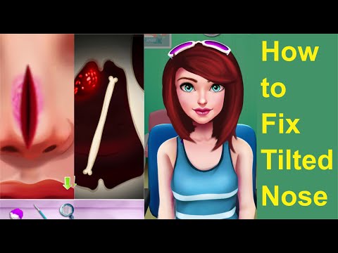 How To Fix Tilted Nose - Surgical Makeup Transformation