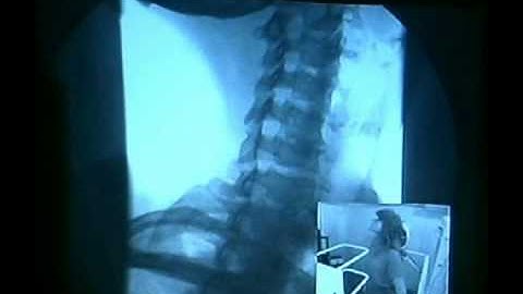 Master Litigation Support Disc Part 11