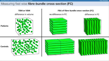 OHBM 2023 | 2733 | Educational Course | Tractometry | Part 8