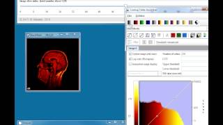 Histogram functions in MIPAV