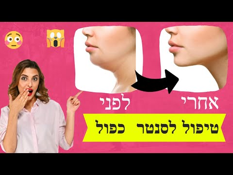 וִידֵאוֹ: אלה פוגצ'בה כמעט מת במהלך ניתוחים פלסטיים בסנטר