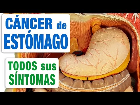 Vídeo: Càncer D’estómac I D’intestí (leiomiosarcoma) En Gossos