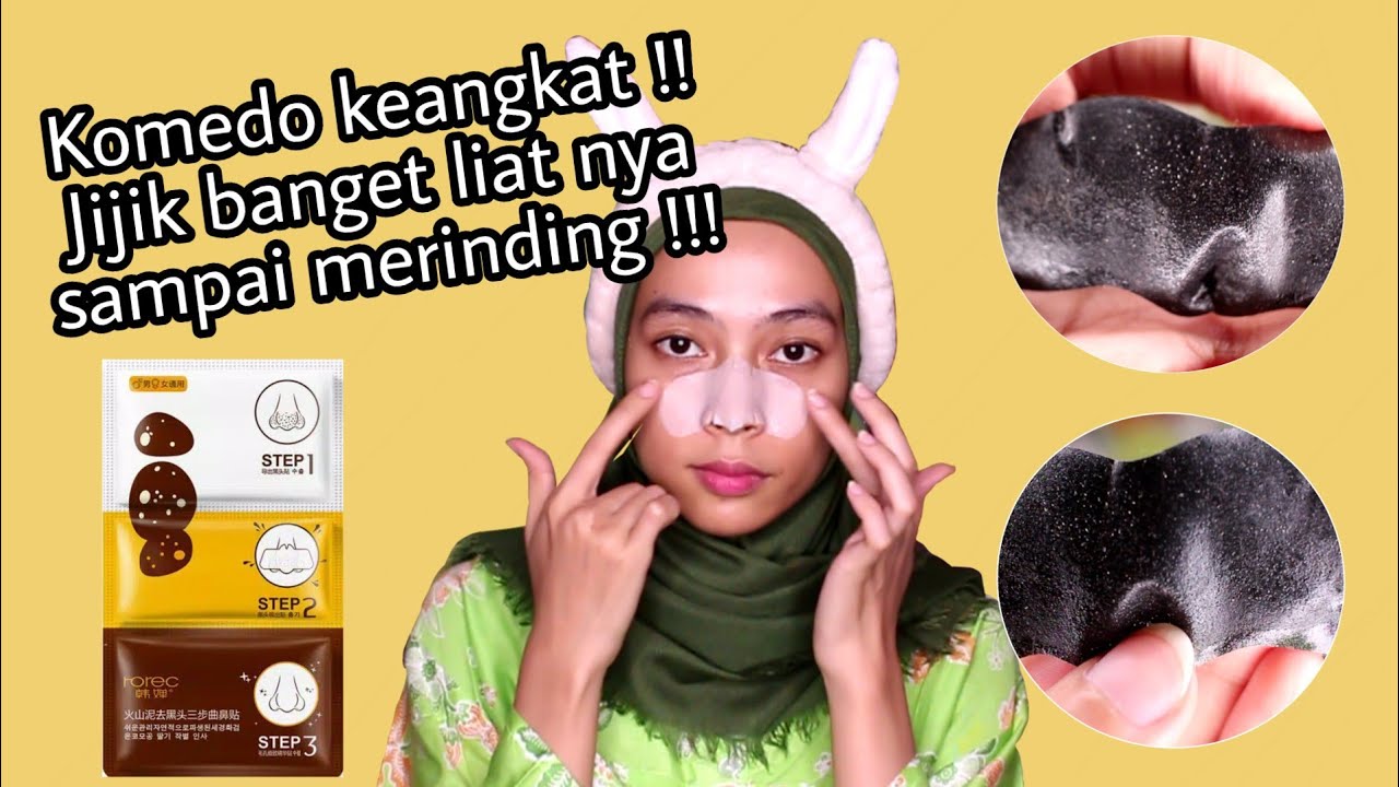 Rorec 3 Step Remove Blackhead Masker Pembersih Komedo Bekas Jerawat Shopee Indonesia