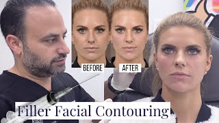 Beverly Hills Facial Fillers Los Angeles Cosmetic Jawline And Neckline Improvement Dr Ben Talei