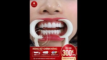 ❌TRỌN BỘ 16 RĂNG SỨ chính hãng từ ĐỨC chỉ 𝟒.𝟖𝐓𝐑 cam kết không phát sinh phí