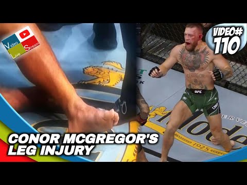 conor mcgregor action figure broken leg
