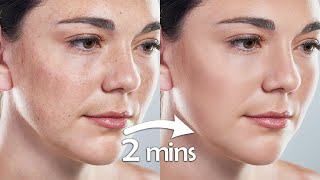 High-End Skin Retouching Photoshop Tutorial for Beginners