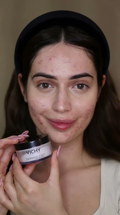 Hailey Bieber makeup tutorial, but on acne skin 🤍