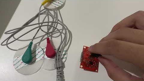 Embedded System 1 Project: IoT Based Electrocardiogram