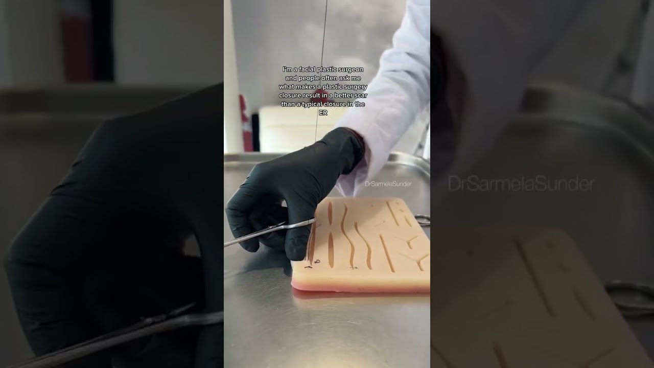 Facial Plastic Surgeon’s Suture Technique | #shorts