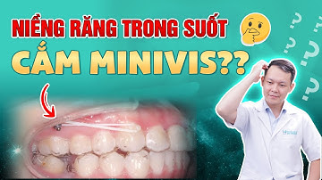 "SỰ THẬT" Về Cắm Minivis khi niềng răng INVISALIGN ? Cắm vít khi niềng răng trong suốt