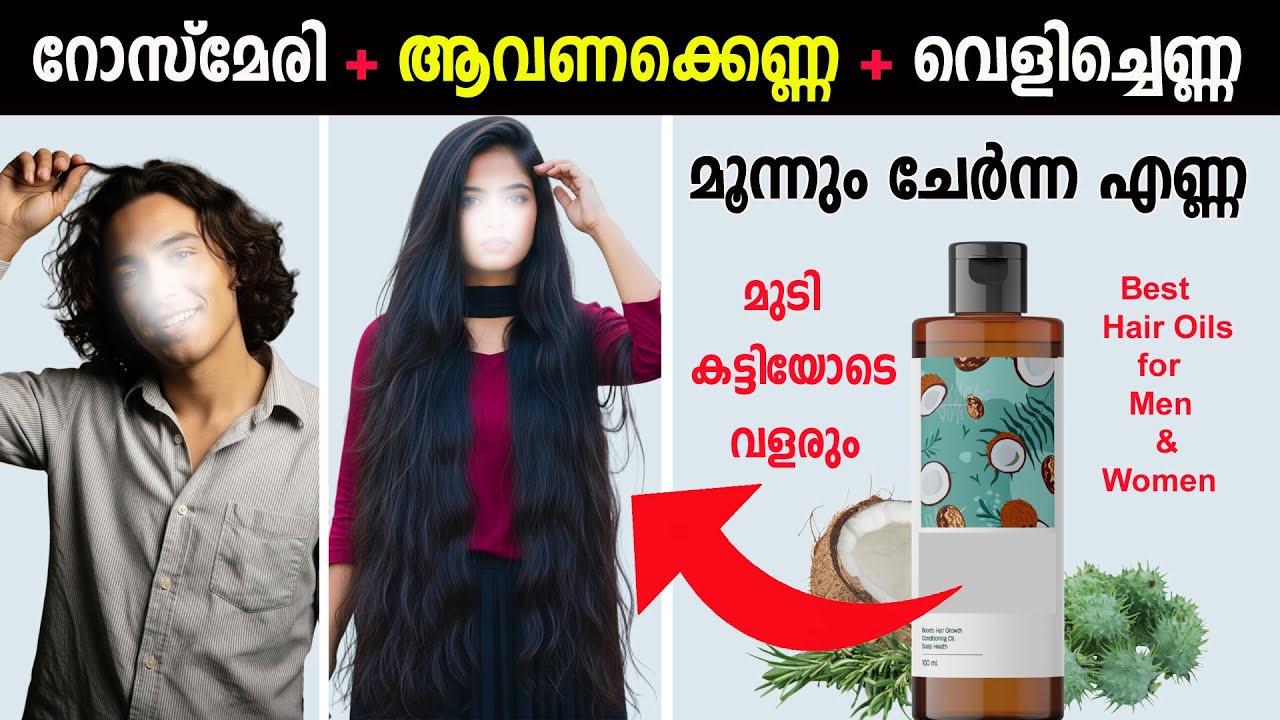 സ്ത്രീകൾക്കും പുരുഷന്മാർക്കും മുടി ഭ്രാന്തുപിടിച്ചു വളരും | Rosemary, Castor & Coconut Oil Malayalam