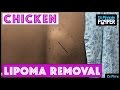 When a Lipoma Removal is as Good as Roscoe's Chicken!