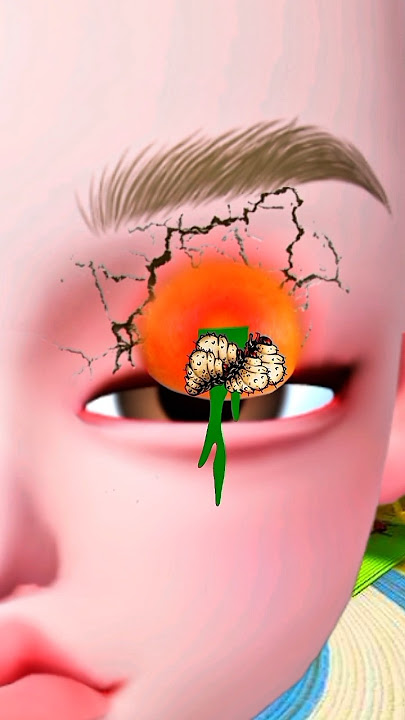 m4ta Ipin swollen because of sleeping | Upin Ipin #upinipin #upinipinhantu #shorts