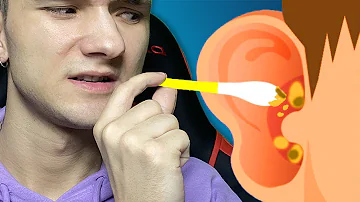 Jak použít svíčku na čištění uší?