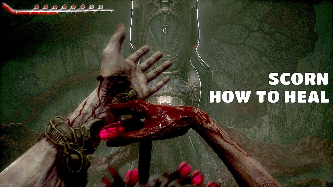 HOW TO HEAL SCORN - SCORN HEALTH - SCORN HEALING - SCORN HOW TO HEAL - HEAL SCORN