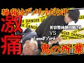 【猫背・美容整体・激痛】悪の元凶「猫背・姿勢改善」|ドエス美容整体師川島さんが10分で改善!|まっちゃんのなんでなん?(猫背改善編)