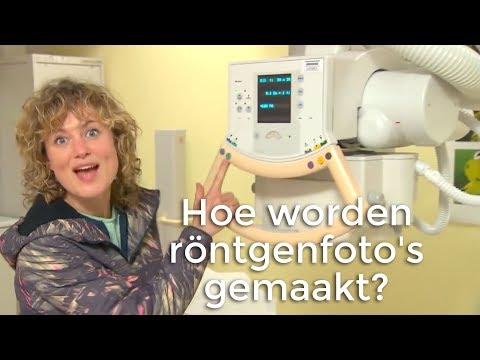 Video: Wanneer Een Röntgenfoto Is Gepland