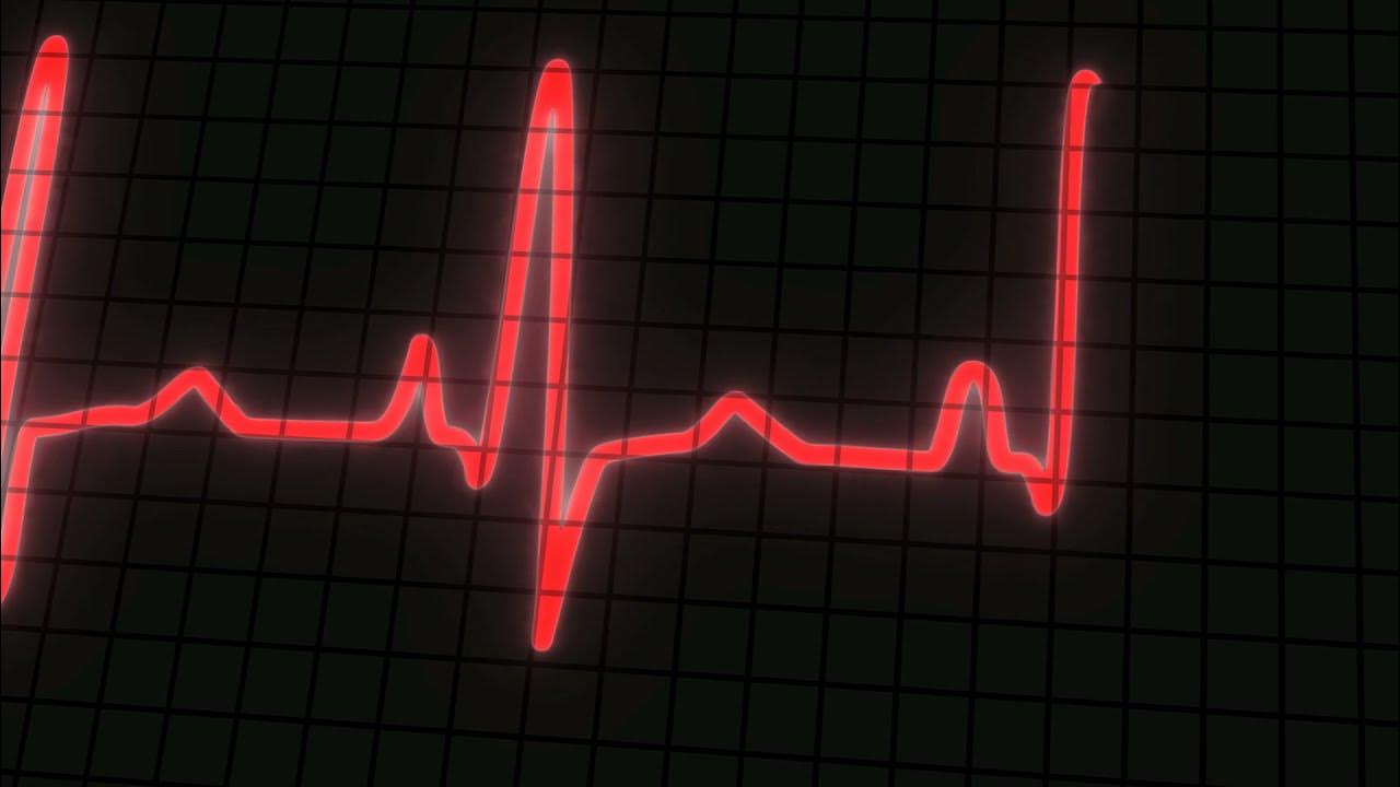 записанное аудио с сердечком. включи звук сердце. биение сердца аудио. звук сердца. линия остановки сердца.