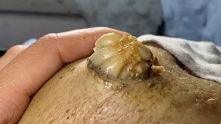 𝑭𝒂𝒄𝒊𝒂𝒍 𝑪𝒍𝒆𝒂𝒏𝒔𝒊𝒏𝒈 𝑭𝒂𝒄𝒆𝒐𝒇𝒇 𝑴𝒊𝒄𝒆𝒍𝒍𝒂𝒓 𝑾𝒂𝒕𝒆𝒓 𝒗𝒔 𝑪𝒍𝒆𝒂𝒏𝒔𝒊𝒏𝒈 𝑶𝒊𝒍 𝒇𝒐𝒓 𝑰𝒏𝒏𝒆𝒓 𝑷𝒆𝒂𝒄𝒆 #9661